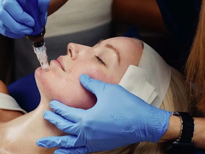 Dr Sharon Delaney Aesthetic Medicine in Portlaoise